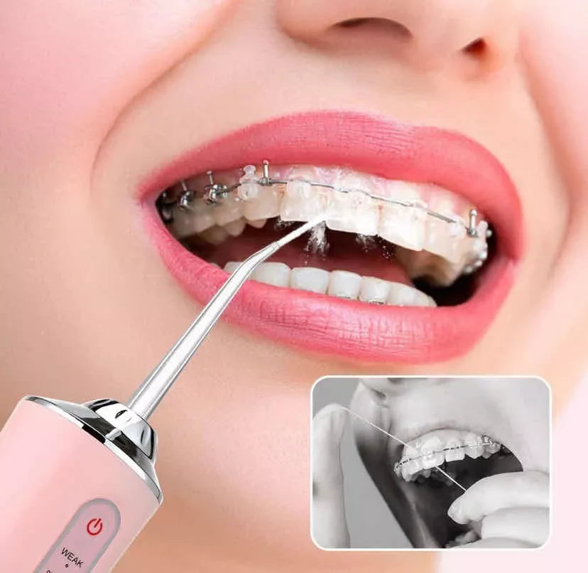 Irrigador Bucal Portátil AquaClean Pro - Limpieza Dental Profesional